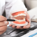 Exploring Treatment Options for Gum Disease